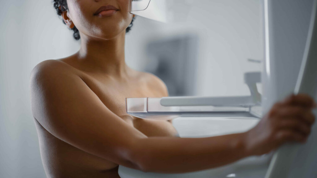 Light skinned woman with short hair standing at mammography machine and holding the right side.